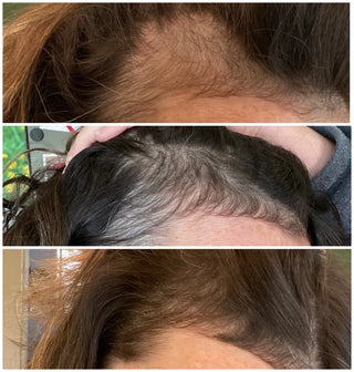 3 images indicating the benefits of collagen on hair regrowth