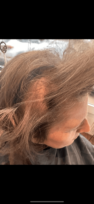 WillPowders customer Hayley, showing her hair