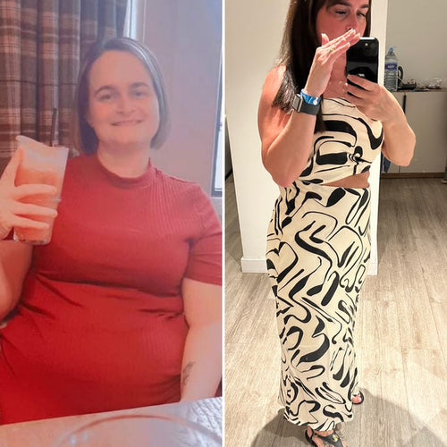 Before and after picture of a woman 
