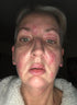 WillPowders Customer Sam Before