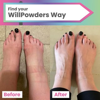 Before and after images of a WillPowders customer showing the effect of ElectroTide on their feet